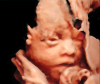 bébé à 29 semaines 